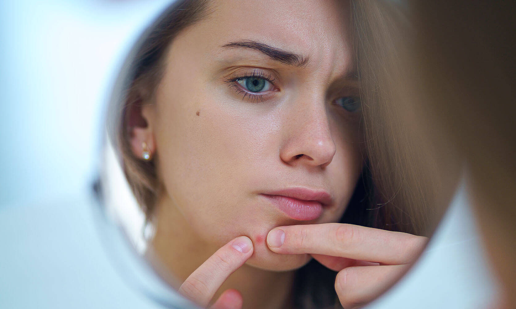 How Long Do Pimples Last?