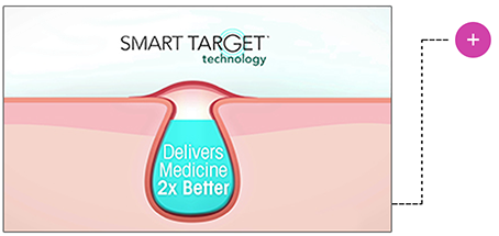 Smart Target